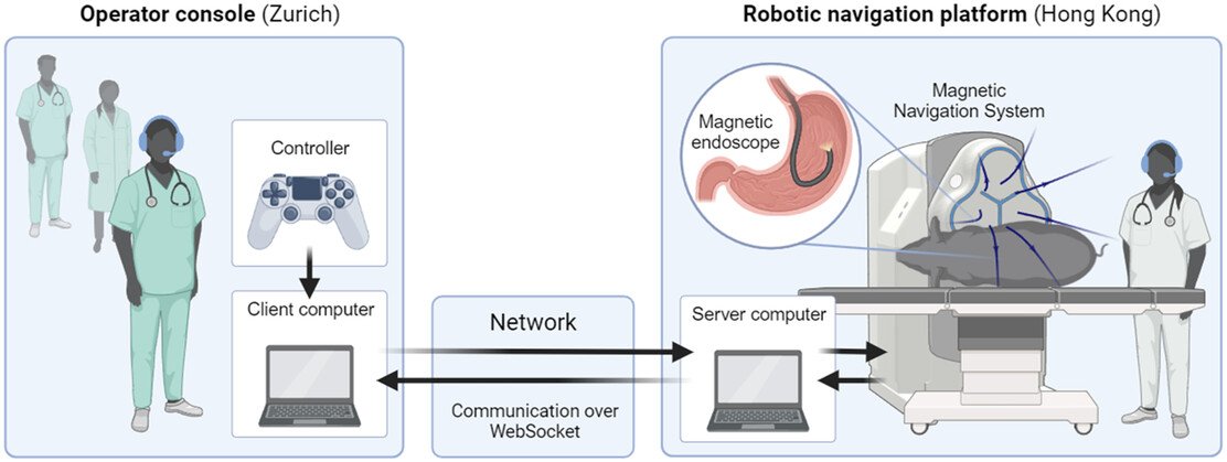 This is how remote endoscopy works This is how remote endoscopy works